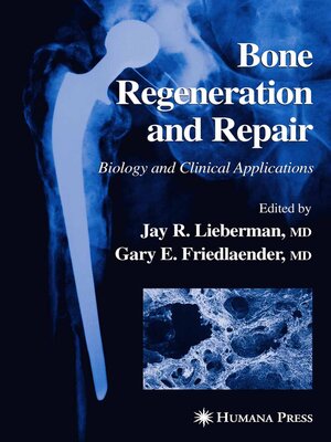 cover image of Bone Regeneration and Repair